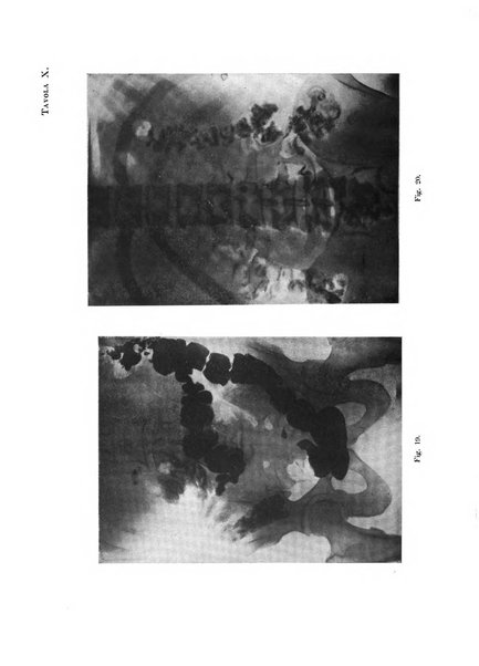 Archivio di radiologia