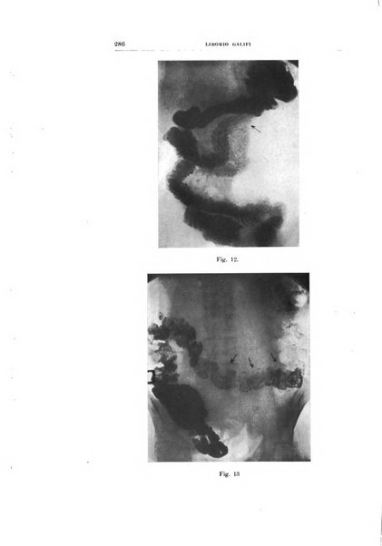 Archivio di radiologia