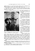 giornale/TO00176855/1936/unico/00000235