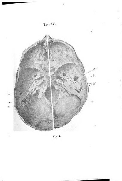 Archivio italiano di otologia, rinologia e laringologia