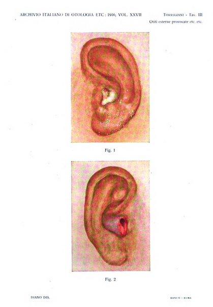 Archivio italiano di otologia, rinologia e laringologia