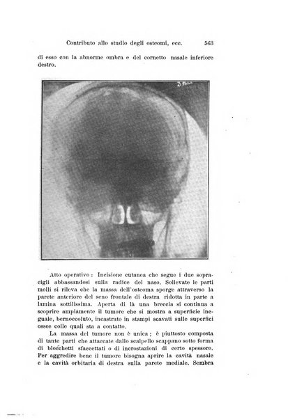 Archivio italiano di otologia, rinologia e laringologia