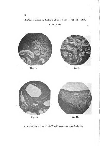 Archivio italiano di otologia, rinologia e laringologia