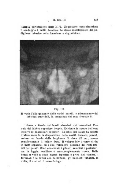 Archivio italiano di otologia, rinologia e laringologia