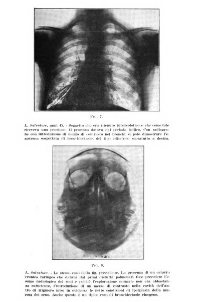 Archivio italiano di otologia, rinologia e laringologia