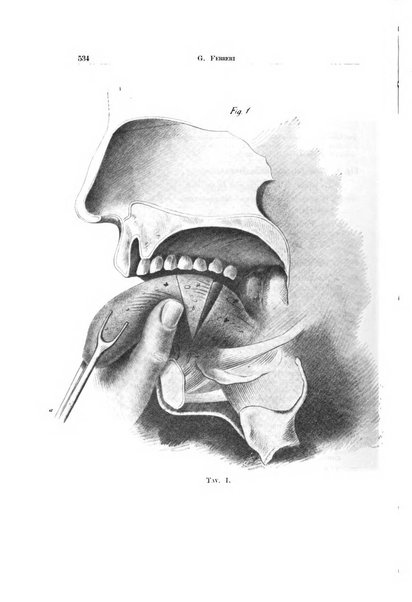 Archivio italiano di otologia, rinologia e laringologia