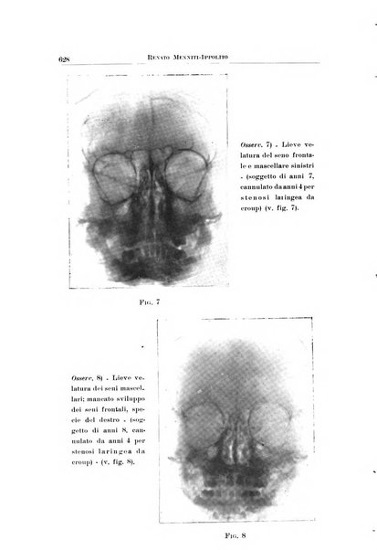 Archivio italiano di otologia, rinologia e laringologia