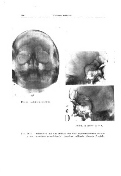 Archivio italiano di otologia, rinologia e laringologia