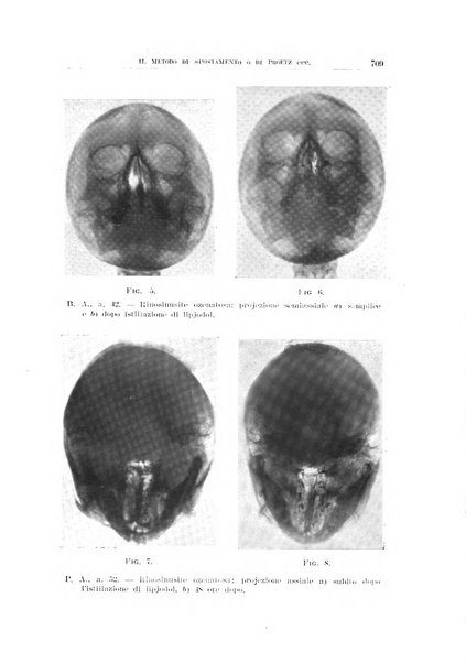 Archivio italiano di otologia, rinologia e laringologia