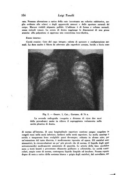 Archivio De Vecchi per l'anatomia patologica e la medicina clinica