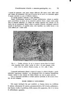giornale/TO00177004/1944-1945/unico/00000081