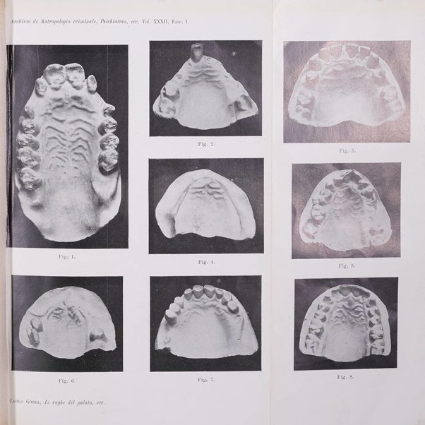 Archivio di antropologia criminale, psichiatria e medicina legale organo ufficiale della Associazione italiana di medicina legale e delle assicurazioni