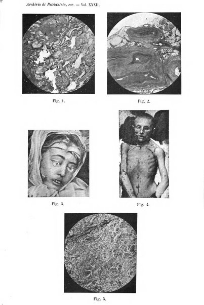 Archivio di antropologia criminale, psichiatria e medicina legale organo ufficiale della Associazione italiana di medicina legale e delle assicurazioni