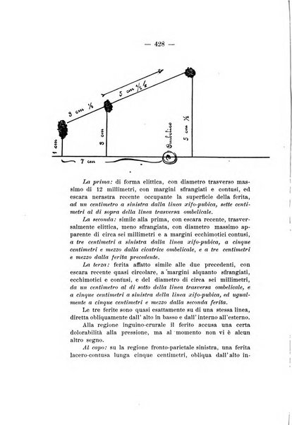 Archivio di antropologia criminale, psichiatria e medicina legale organo ufficiale della Associazione italiana di medicina legale e delle assicurazioni