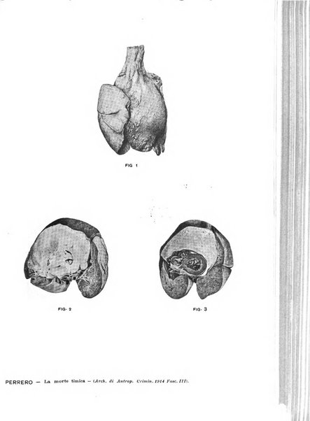 Archivio di antropologia criminale, psichiatria e medicina legale organo ufficiale della Associazione italiana di medicina legale e delle assicurazioni