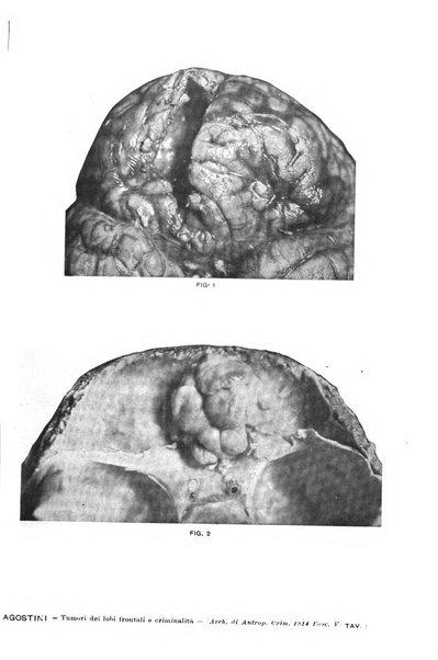 Archivio di antropologia criminale, psichiatria e medicina legale organo ufficiale della Associazione italiana di medicina legale e delle assicurazioni