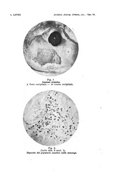 Archivio di antropologia criminale, psichiatria e medicina legale organo ufficiale della Associazione italiana di medicina legale e delle assicurazioni