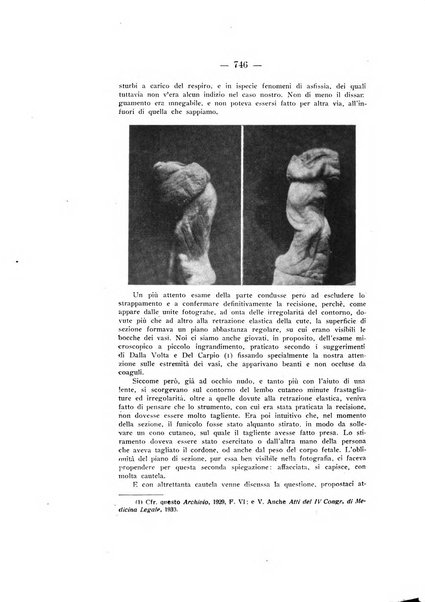 Archivio di antropologia criminale, psichiatria e medicina legale organo ufficiale della Associazione italiana di medicina legale e delle assicurazioni