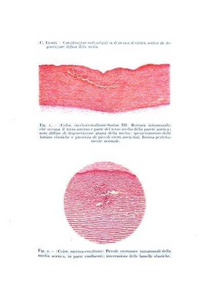 Archivio di antropologia criminale, psichiatria e medicina legale organo ufficiale della Associazione italiana di medicina legale e delle assicurazioni