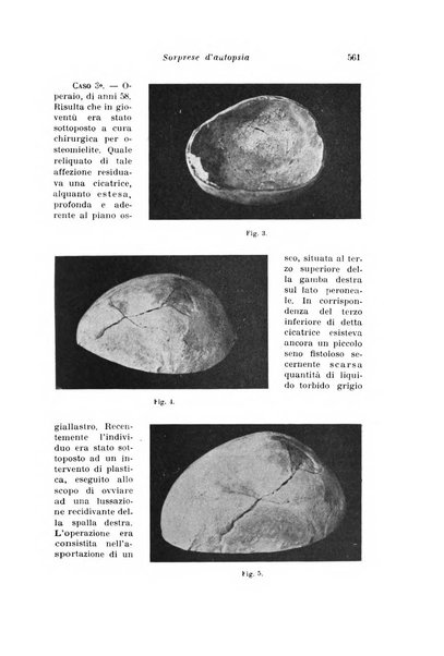 Archivio di antropologia criminale, psichiatria e medicina legale organo ufficiale della Associazione italiana di medicina legale e delle assicurazioni