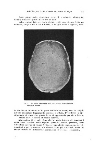 Archivio di antropologia criminale, psichiatria e medicina legale organo ufficiale della Associazione italiana di medicina legale e delle assicurazioni