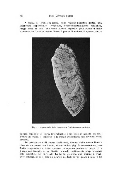 Archivio di antropologia criminale, psichiatria e medicina legale organo ufficiale della Associazione italiana di medicina legale e delle assicurazioni