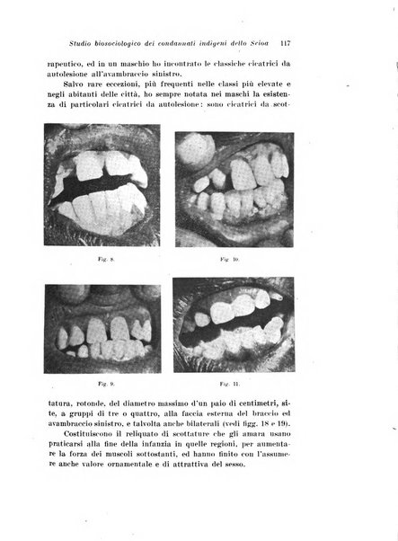 Archivio di antropologia criminale, psichiatria e medicina legale organo ufficiale della Associazione italiana di medicina legale e delle assicurazioni