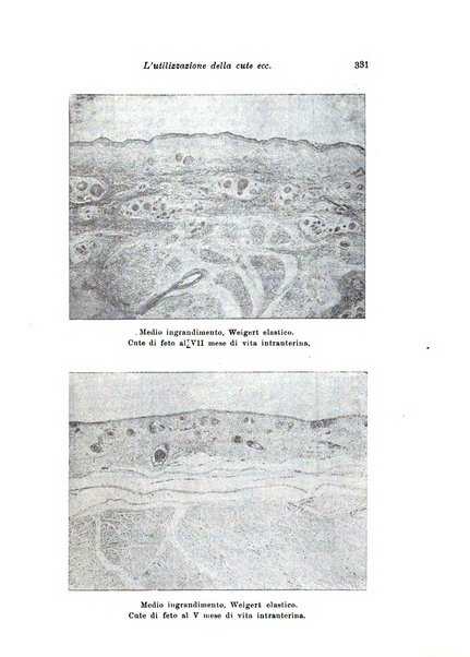 Archivio di antropologia criminale, psichiatria e medicina legale organo ufficiale della Associazione italiana di medicina legale e delle assicurazioni