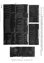 giornale/TO00177025/1914/unico/00000075