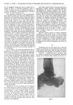 giornale/TO00177347/1935/unico/00000042