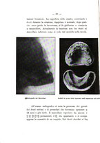 giornale/TO00177621/1914/v.3/00000074