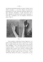 giornale/TO00177621/1914/v.3/00000095