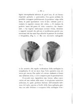 giornale/TO00177621/1914/v.3/00000096