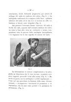 giornale/TO00177621/1914/v.3/00000097