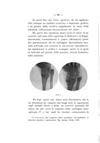 giornale/TO00177621/1914/v.3/00000098