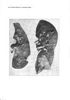 giornale/TO00177621/1920/v.9/00000047
