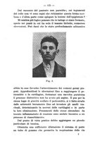 giornale/TO00179184/1928-1929/unico/00000635