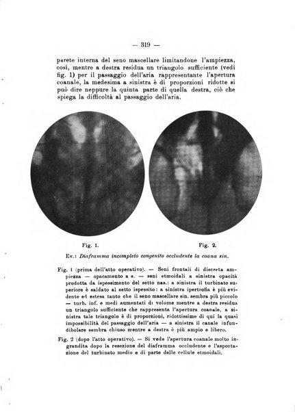 Bollettino delle malattie dell'orecchio, della gola e del naso