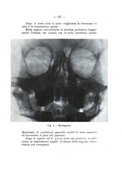 Bollettino delle malattie dell'orecchio, della gola e del naso