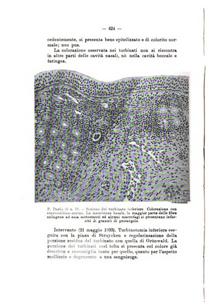 Bollettino delle malattie dell'orecchio, della gola e del naso