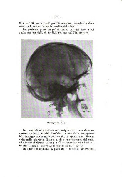 Bollettino delle malattie dell'orecchio, della gola e del naso