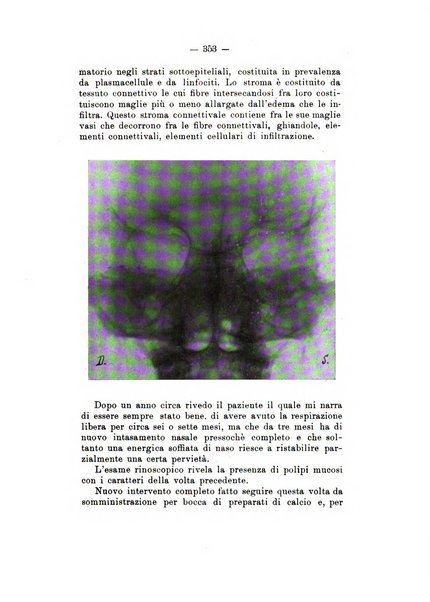 Bollettino delle malattie dell'orecchio, della gola e del naso