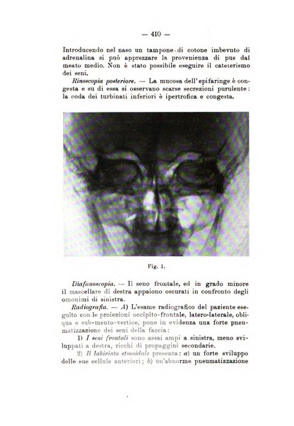 Bollettino delle malattie dell'orecchio, della gola e del naso