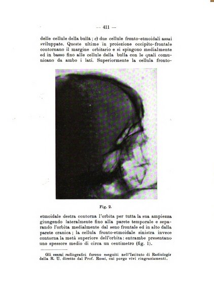 Bollettino delle malattie dell'orecchio, della gola e del naso