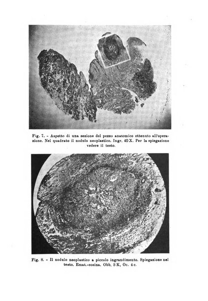 Bollettino delle malattie dell'orecchio, della gola e del naso