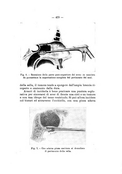 Bollettino delle malattie dell'orecchio, della gola e del naso