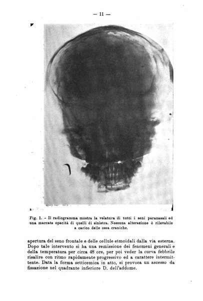 Bollettino delle malattie dell'orecchio, della gola e del naso