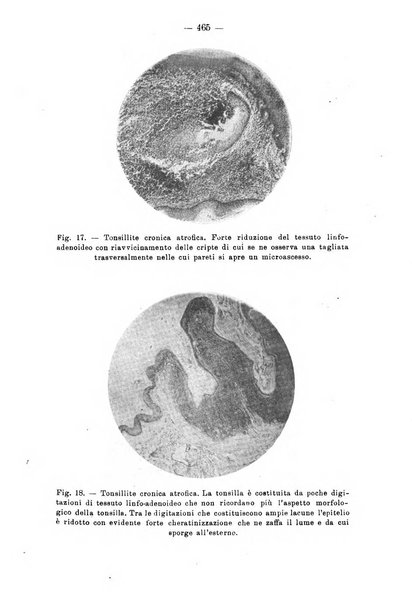 Bollettino delle malattie dell'orecchio, della gola e del naso