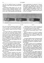 giornale/TO00180802/1935/unico/00000150