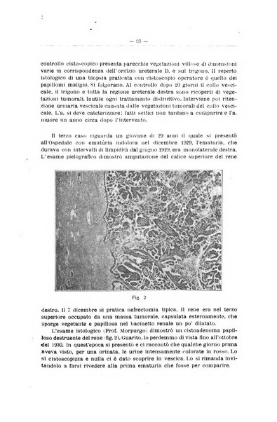 Il Cancro rivista trimestrale del centro per lo studio, diagnosi e cura dei tumori